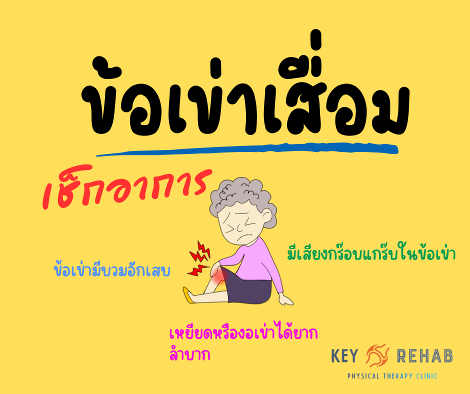 ข้อเข่าเสื่อม - osteoarthritis of knee 1