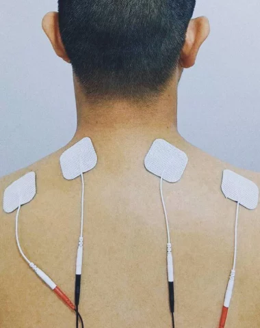Electrical Stimulation (กระตุ้นไฟฟ้า)
